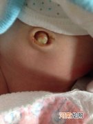 正确护理宝宝肚脐 远离病菌入侵