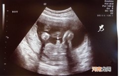 胎儿最晚几个月小JJ开始发育 这时候b超基本准了