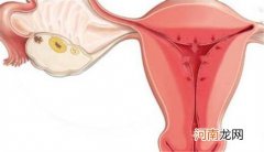 宫内膜过厚会影响怀孕 子宫内膜厚能正常怀孕吗
