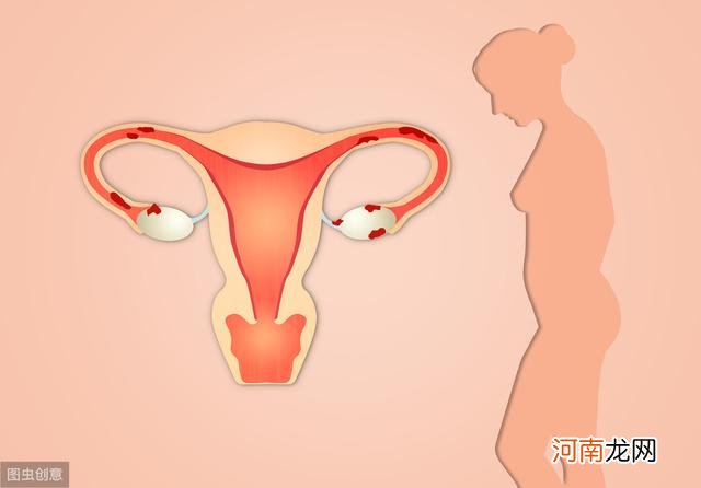 夫妻同房出血是什么原因 夫妻同房时女方出血是什么原因