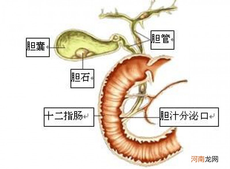 为什么胆结石疼就想拉大便