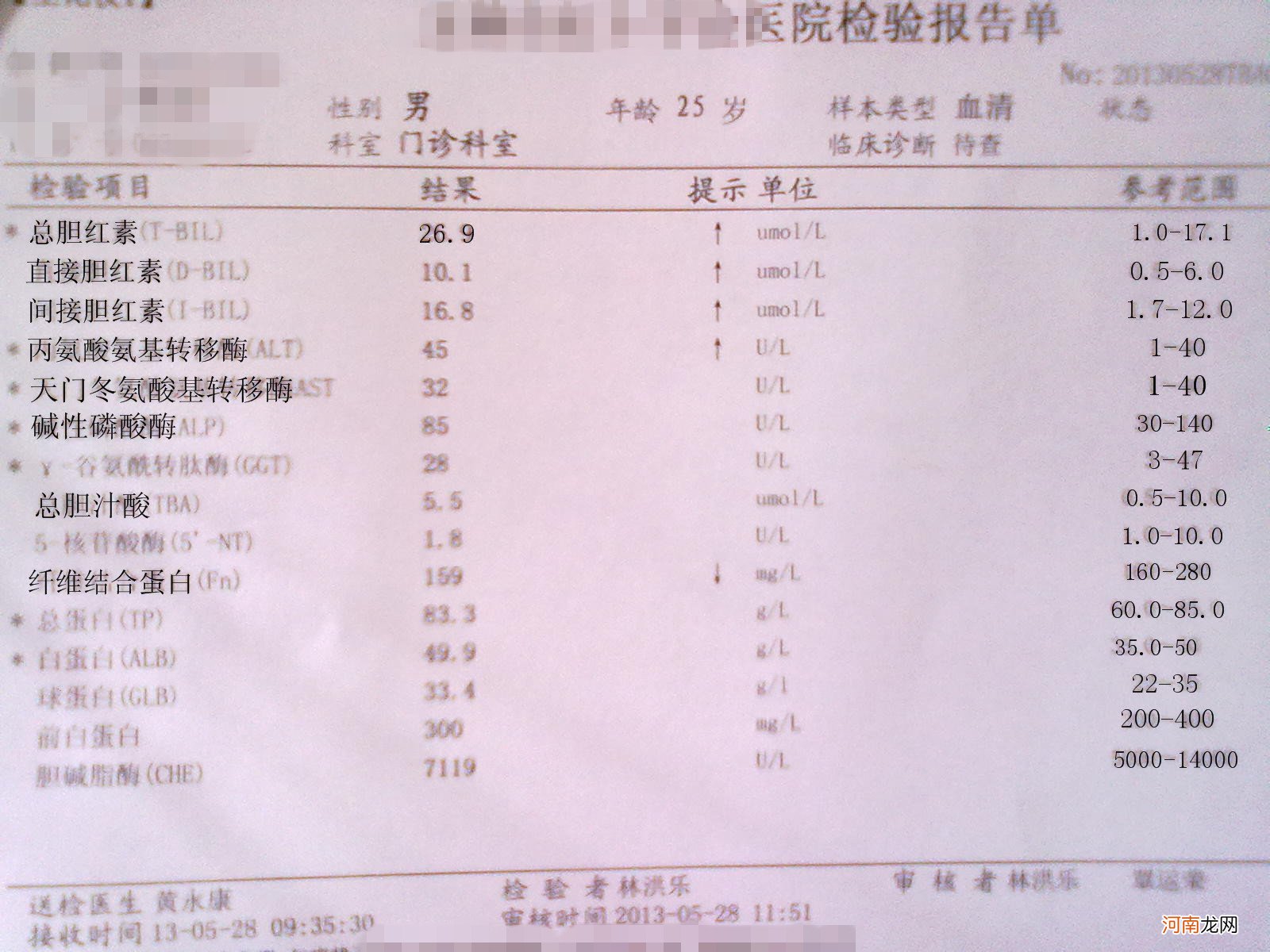 正常的肝功能报告单