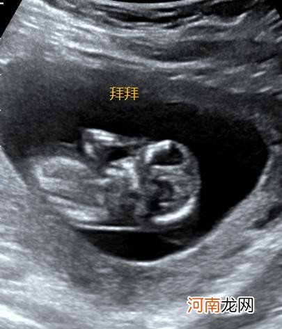 怀孕三个月的胎儿是什么样子的 怀孕三个月的胎儿图