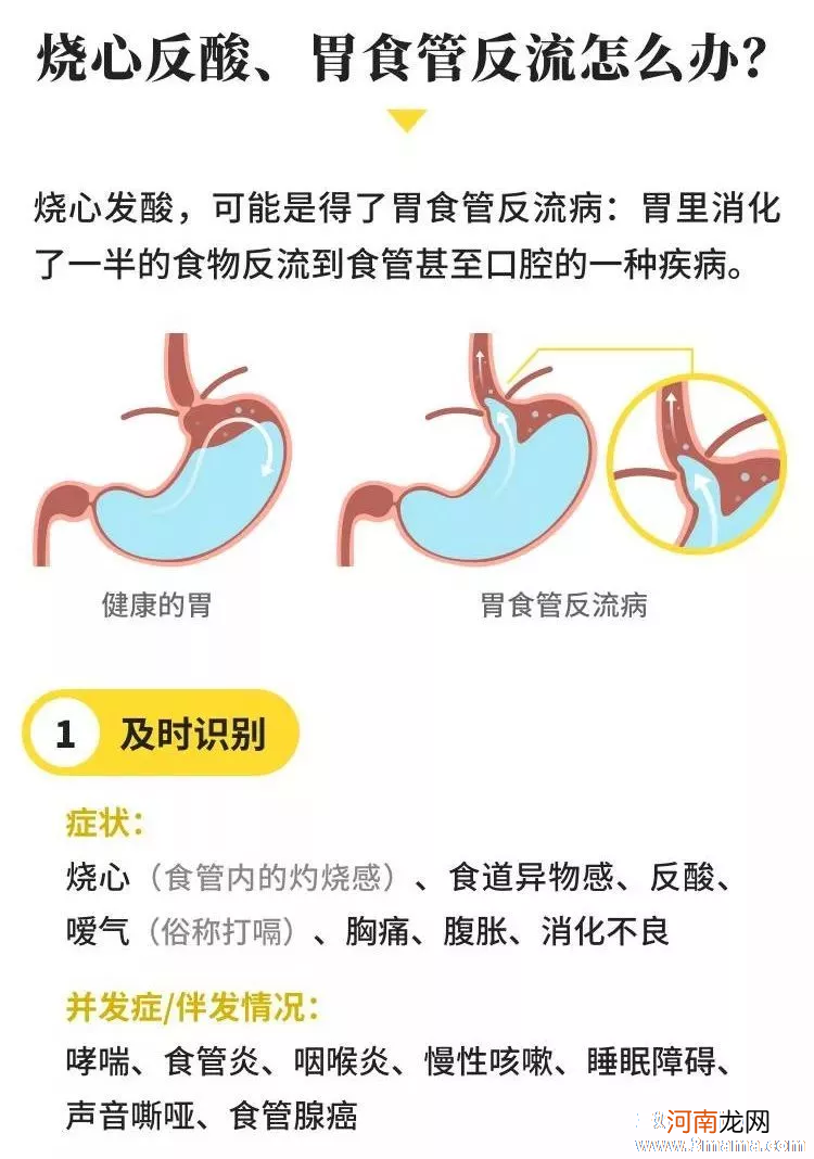 孕晚期胃反酸怎么办