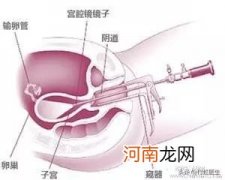 剖腹产后多久来月经正常？ - 剖腹产