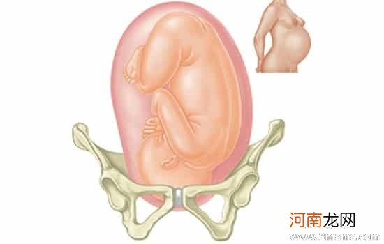 孕晚期胎儿压迫膀胱