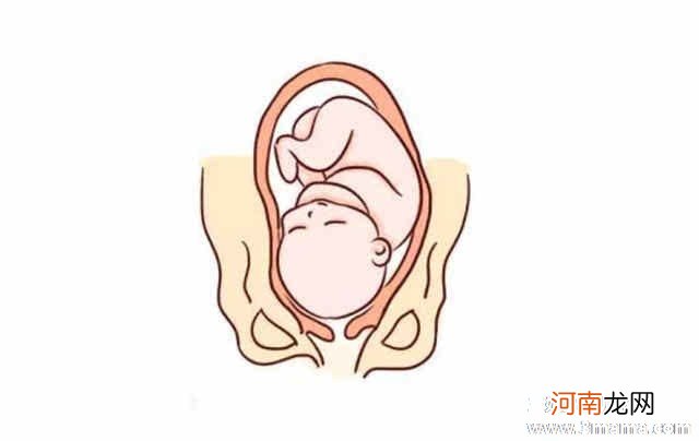 孕晚期roa胎位图