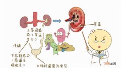 小儿尿路感染有哪些症状？ 小孩泌尿系统感染能自愈吗