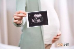 婴儿性别鉴定最新方法 怀孕测男女最准的98%
