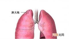 有肺大泡怎么治疗