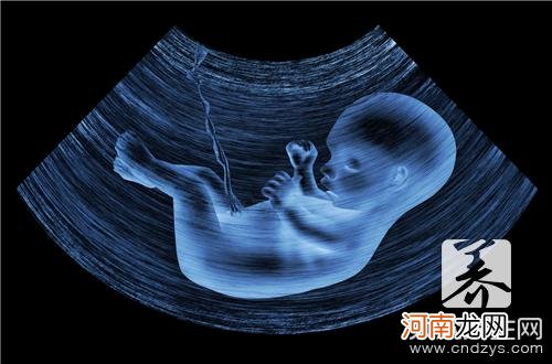 孕16周b超生殖部位图
