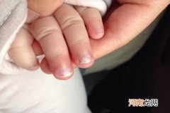 六个月宝宝缺锌的9个症状 前面三个表现最常见