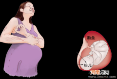 孕晚期胆汁淤积症图片