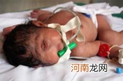 警惕:中国每30秒降生一个有缺陷婴儿