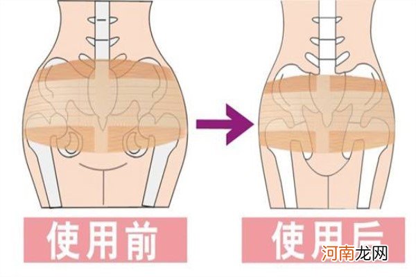 欧赫曼骨盆矫正带好吗 不会上窜下滑实力杠杠的矫正带