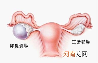 肝囊肿吃什么食物好