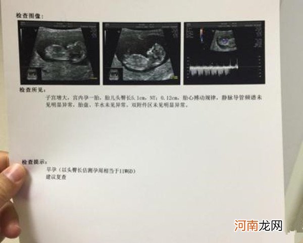 从nt报告单怎么看男女 nt图看男女已生验证