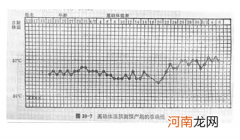 女性的基础体温有多重要,你知道吗