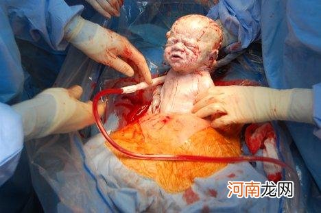 剖腹产后不慎怀孕很危险