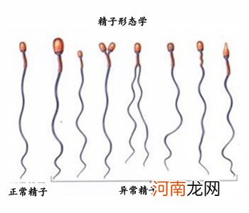 畸形精子多会影响生育