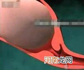 图解 女人是怎么生孩子的？婴儿出生全过程 - 顺产