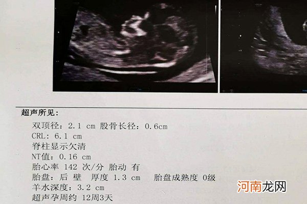 怀孕12周胎儿图测男女 nt男孩女孩区别图