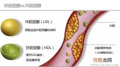 孕晚期总胆固醇偏高