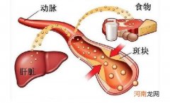 老年人胆固醇高吃什么食物好