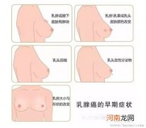 提醒：有乳癌家族史的妈妈不宜哺乳