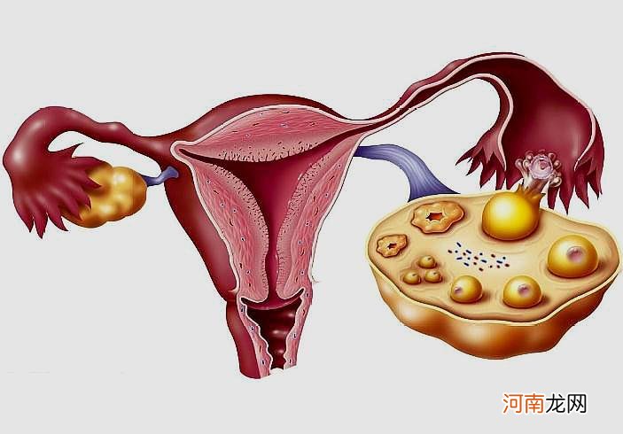 7个症状暗示卵巢早衰