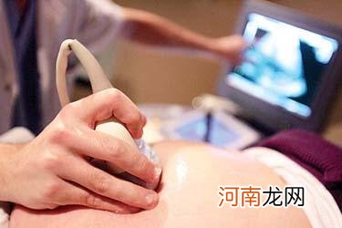 羊膜穿刺测胎儿性别应在孕期第几个月