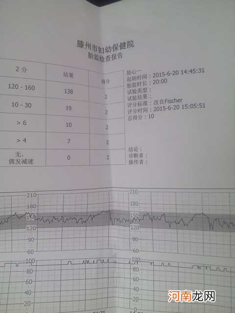 怀孕日记：胎儿不动，胎监就得重新做