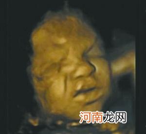 4D超声波揭示胎儿丰富表情
