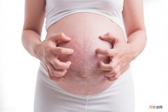 妊娠纹是否可以消除 橄榄油真的可以淡化妊娠纹吗