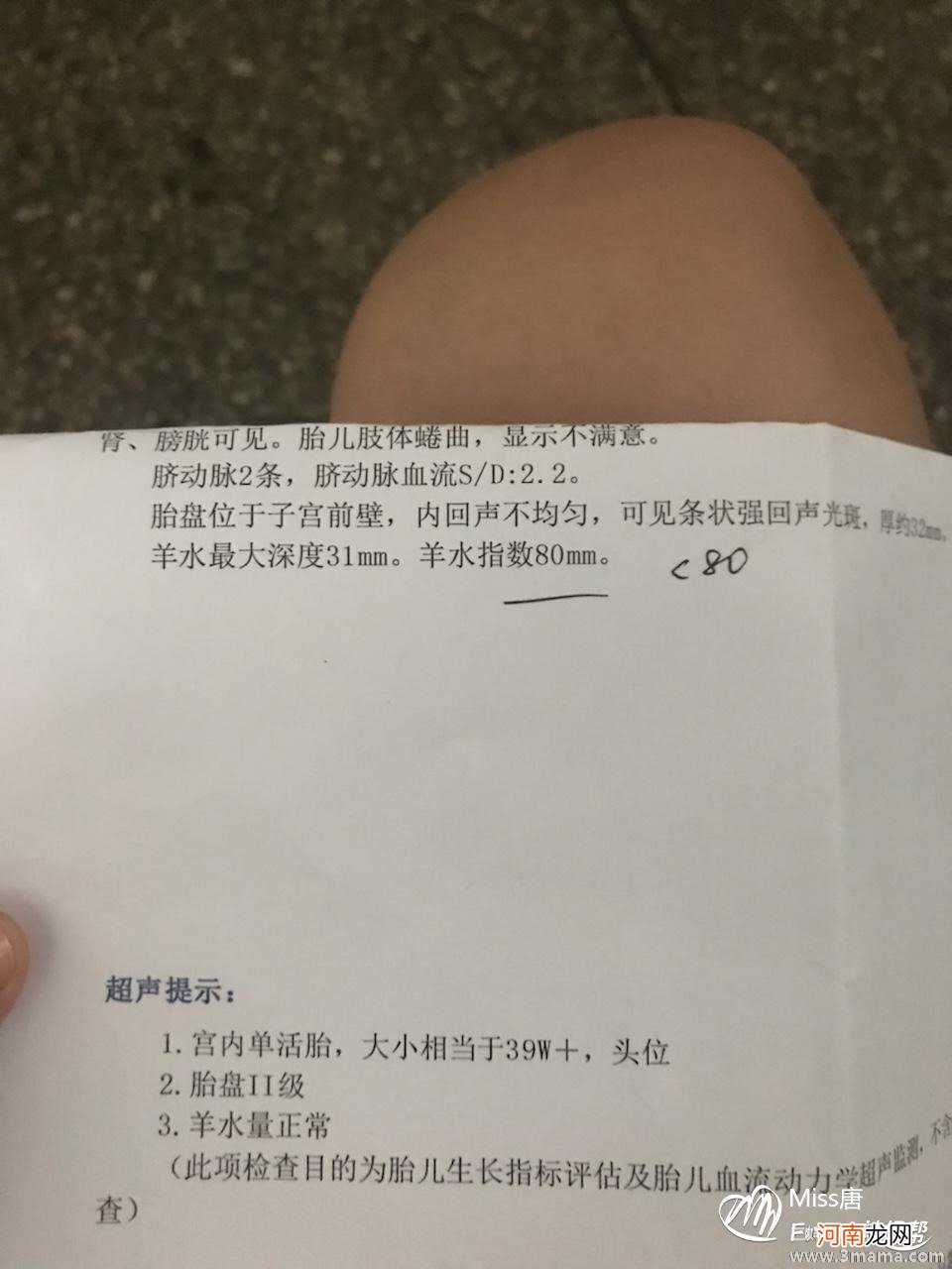 羊水指数60mm能顺产吗