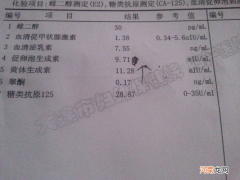 性激素六项怎么看报告单