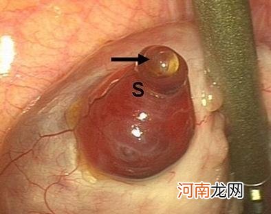 女性排卵了怎么还不孕