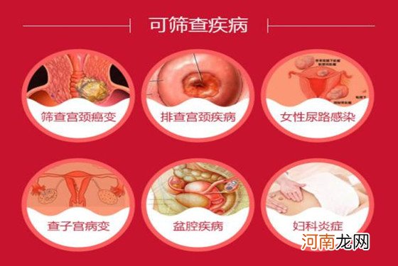 tct检查是什么 原来是最熟悉的它的英文缩写