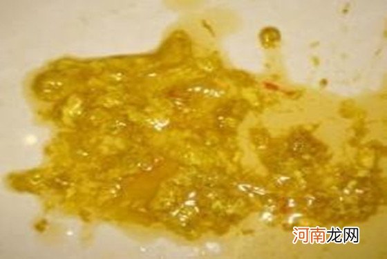 轮状病毒症状大便图片 嫌恶心的最好别看