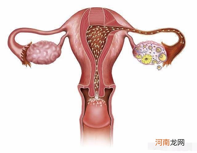 宫外孕是什么原因造成的 宫外孕怎么处理最好