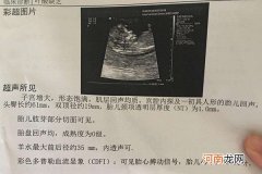 12周nt值多少是女孩 nt小于这个值85%是女孩