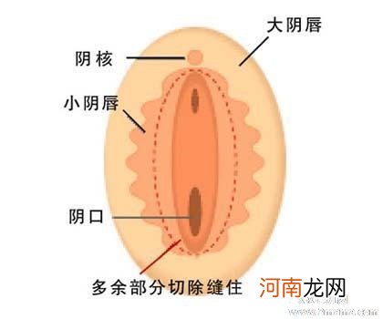 孕晚期阴唇变厚图片