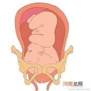 什么是胎儿入盆