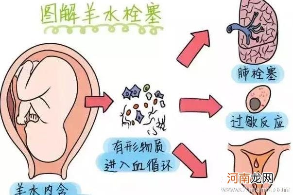 什么时候开始有羊水