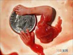 胚胎停育做无痛人流还是清宫