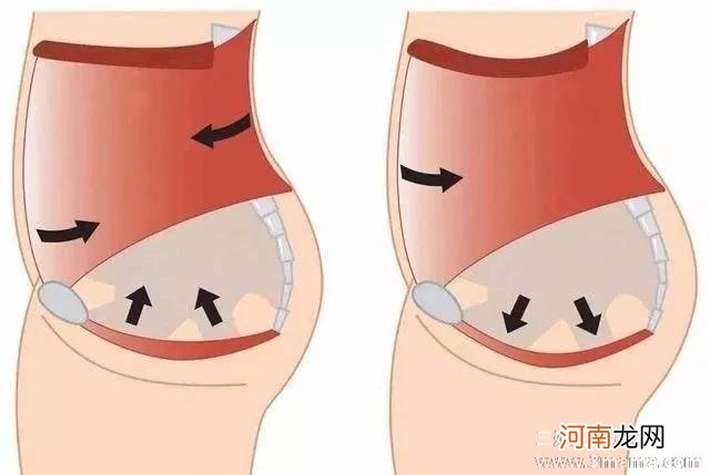 顺产后缩肛运动图解