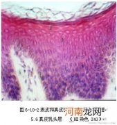 顺产伤口长肉芽图片