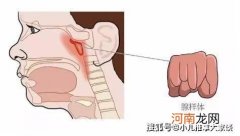 儿童腺样体肥大保守治疗方法