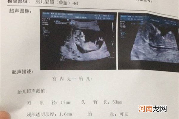 超准 胎囊形状看男女 生了男孩当时42天孕囊