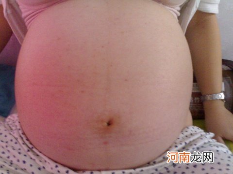 孕29周提早防范新生儿溶血症